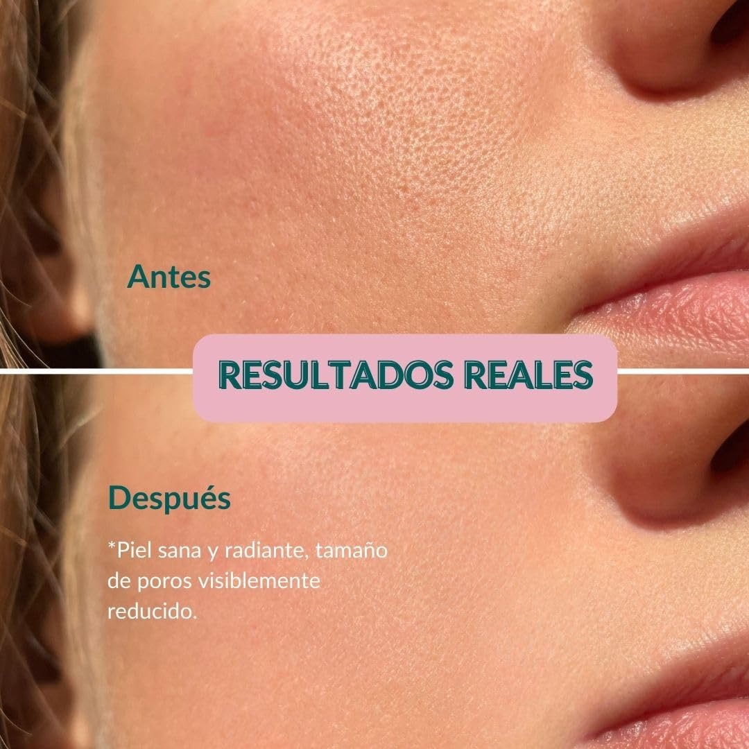 GlowMask™- Mascarilla LED rejuvenecedora