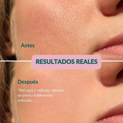 GlowMask™- Mascarilla LED rejuvenecedora